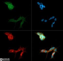 Immunocytochemistry/Immunofluorescence: BAI1 Antibody [NB110-81586] - BAI1 antibody was tested in SH-SY-5Y cells with Dylight 488 (green). Nuclei and alpha-tubulin were counterstained with DAPI (blue) and Dylight 550 (red).