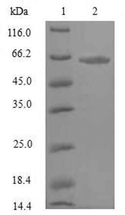 (Tris-Glycine gel) Discontinuous SDS-PAGE (reduced) with 5% enrichment gel and 15% separation gel.