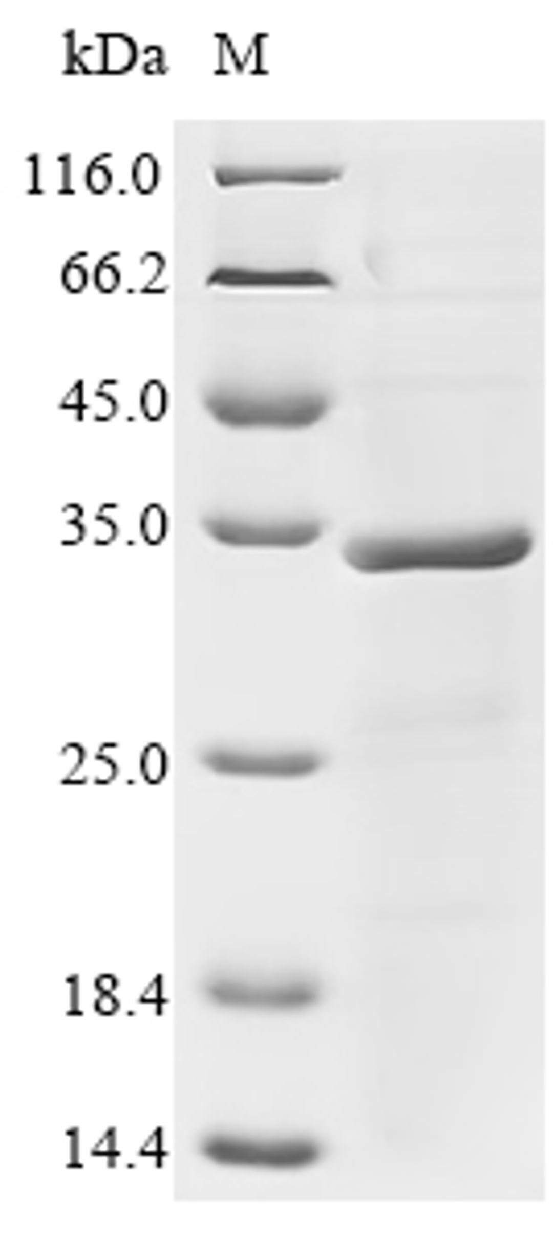(Tris-Glycine gel) Discontinuous SDS-PAGE (reduced) with 5% enrichment gel and 15% separation gel.