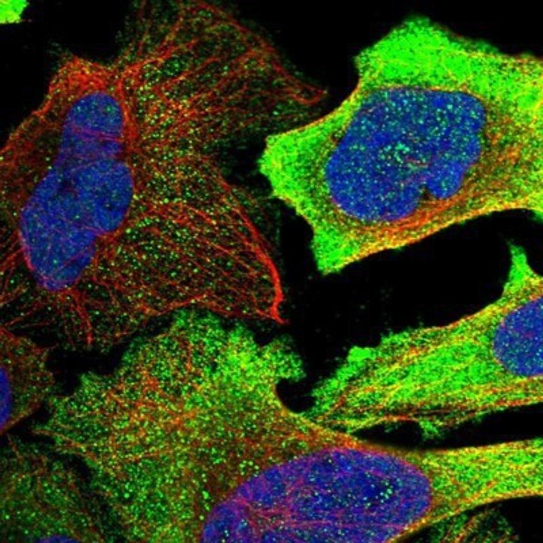 Immunocytochemistry/Immunofluorescence: EHHADH Antibody [NBP1-84915] - Staining of human cell line U-2 OS shows positivity in cytoplasm & vesicles.