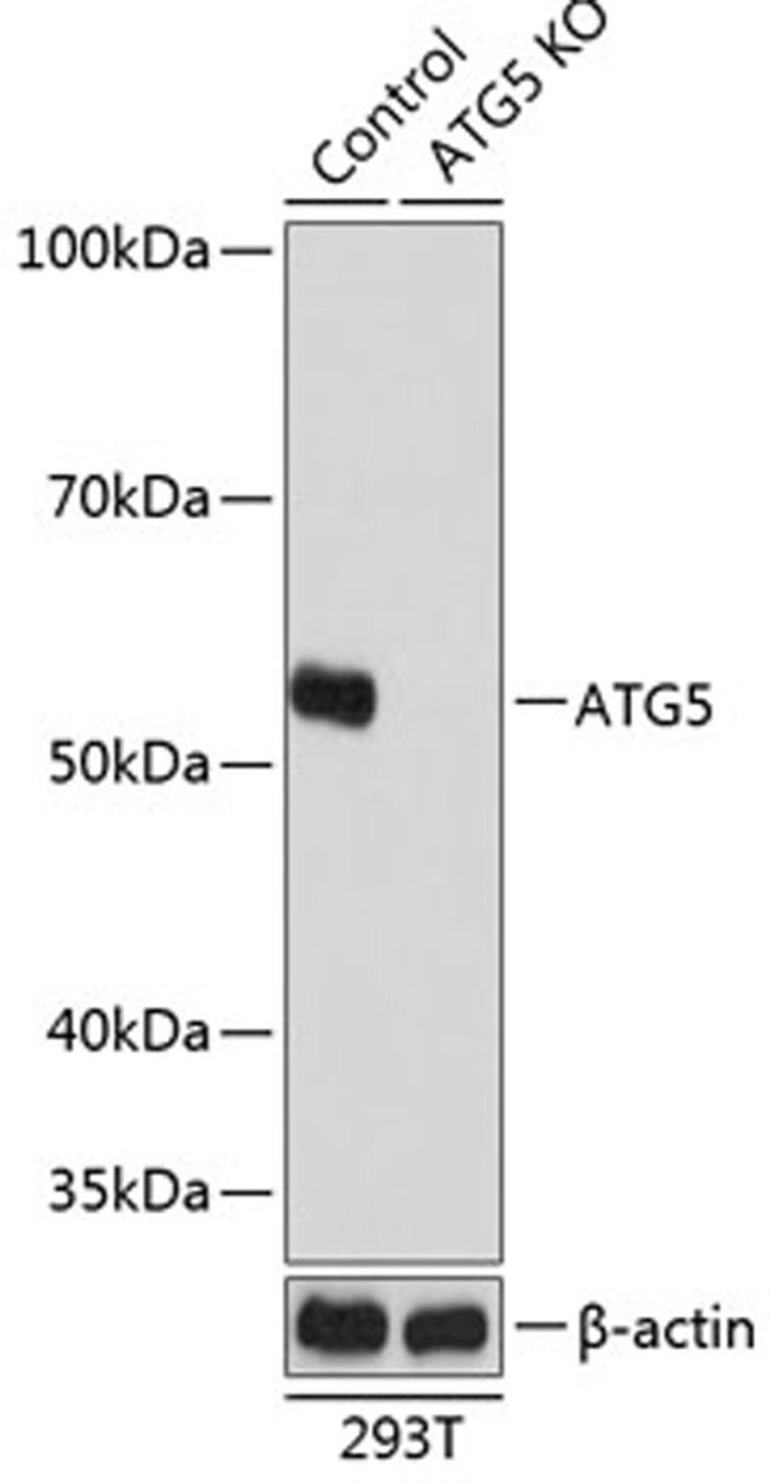 Western blot - ATG5 antibody (A19677)