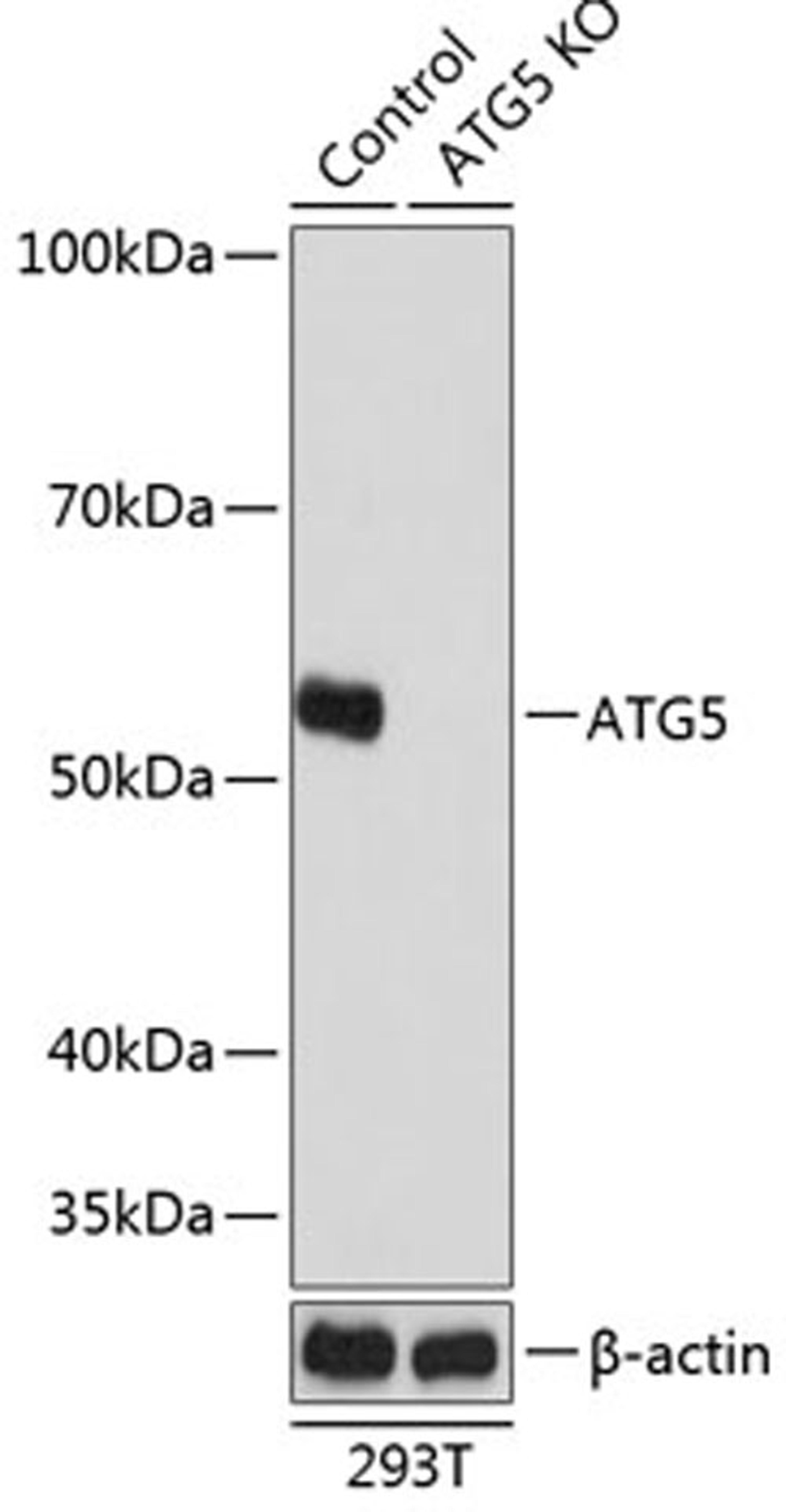 Western blot - ATG5 antibody (A19677)