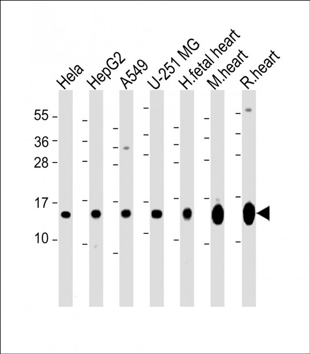 Western Blot at 1:2000 dilution Lane 1: Hela whole cell lysate Lane 2: HepG2 whole cell lysate Lane 3: A549 whole cell lysate Lane 4: U-251 MG whole cell lysate Lane 5: human fetal heart lysate Lane 5: mouse heart lysate Lane 5: rat heart lysate Lysates/p