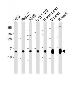 Western Blot at 1:2000 dilution Lane 1: Hela whole cell lysate Lane 2: HepG2 whole cell lysate Lane 3: A549 whole cell lysate Lane 4: U-251 MG whole cell lysate Lane 5: human fetal heart lysate Lane 5: mouse heart lysate Lane 5: rat heart lysate Lysates/p