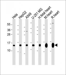 Western Blot at 1:2000 dilution Lane 1: Hela whole cell lysate Lane 2: HepG2 whole cell lysate Lane 3: A549 whole cell lysate Lane 4: U-251 MG whole cell lysate Lane 5: human fetal heart lysate Lane 5: mouse heart lysate Lane 5: rat heart lysate Lysates/p