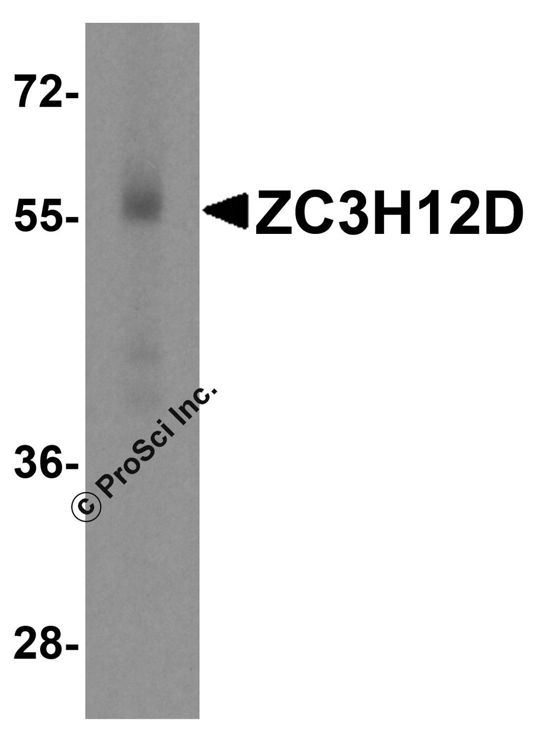 Western blot analysis of ZC3H12D in human spleen tissue lysate with ZC3H12D antibody at 1 &#956;g/mL.