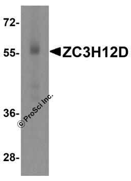 Western blot analysis of ZC3H12D in human spleen tissue lysate with ZC3H12D antibody at 1 μg/mL.