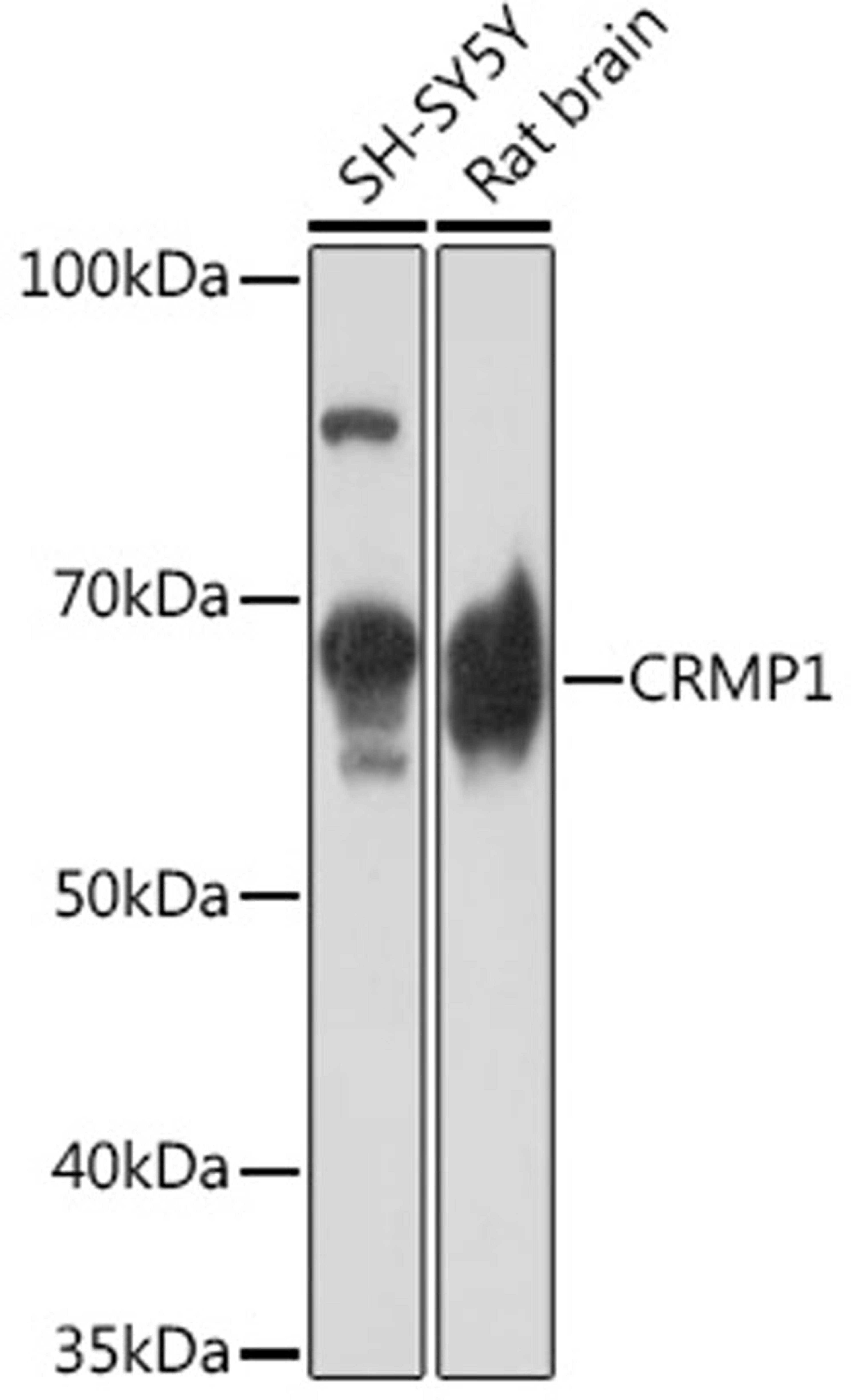 Western blot - CRMP1 Rabbit mAb (A2390)