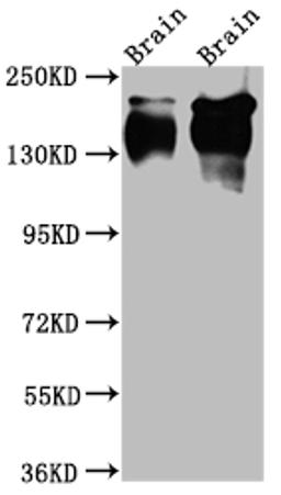 Western Blot. Positive WB detected in: Rat Brain whole cell lysate, Mouse Brain whole cell lysate. All lanes: TrkA Antibody at 1:1000. Secondary. Goat polyclonal to rabbit IgG at 1/50000 dilution. Predicted band size: 88, 87, 84, 78 kDa. Observed band size: 145 kDa.