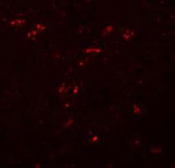 Immunocytochemistry/Immunofluorescence: ZNF536 Antibody [NBP1-77092] - Immunofluorescence of ZNF536 in human brain tissue with ZNF536 antibody at 20 ug/mL.