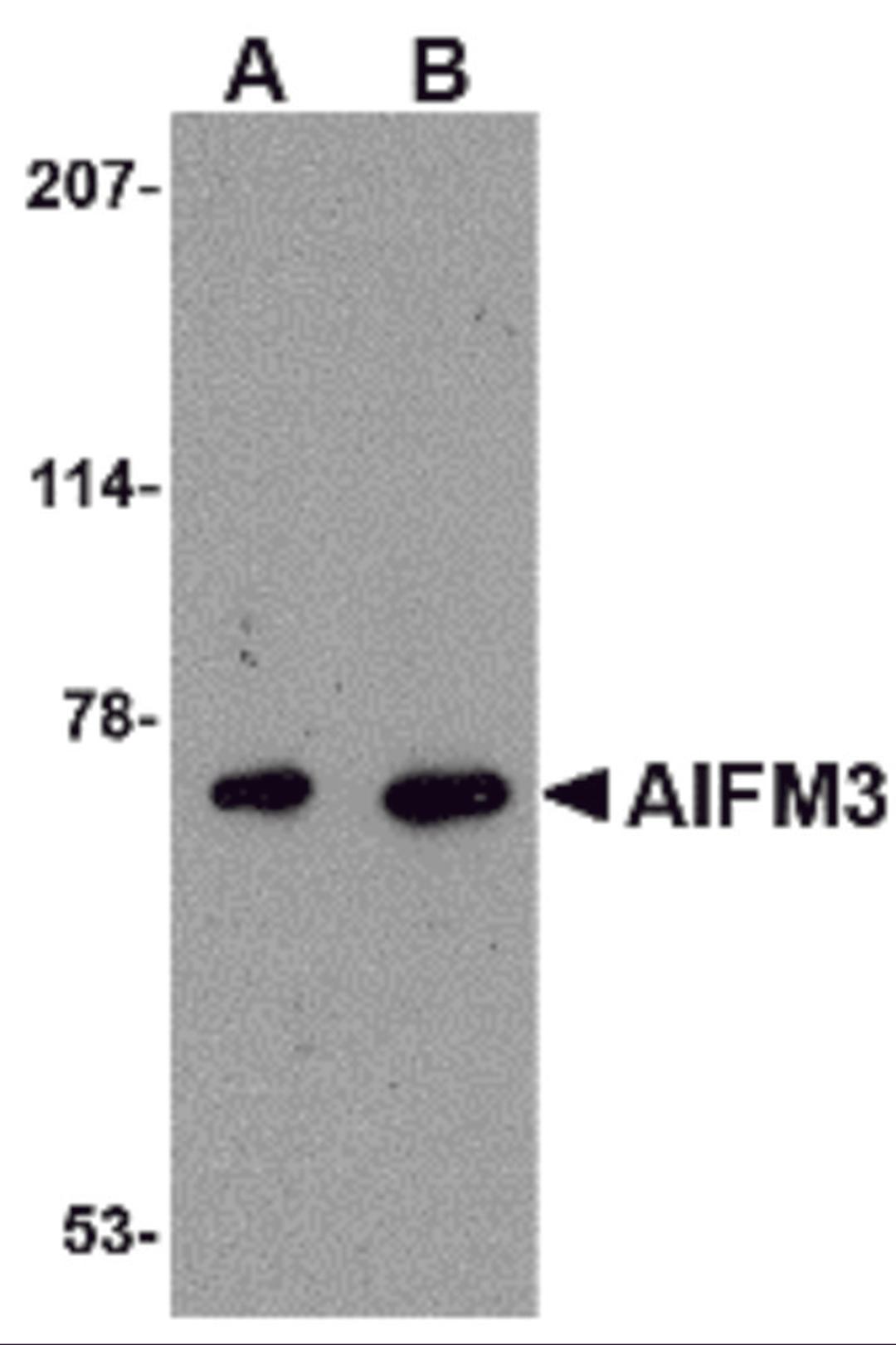 Western blot analysis of AIFM3 in human brain tissue lysate with AIFM3 antibody at (A) 1 and (B) 2 μg/mL.