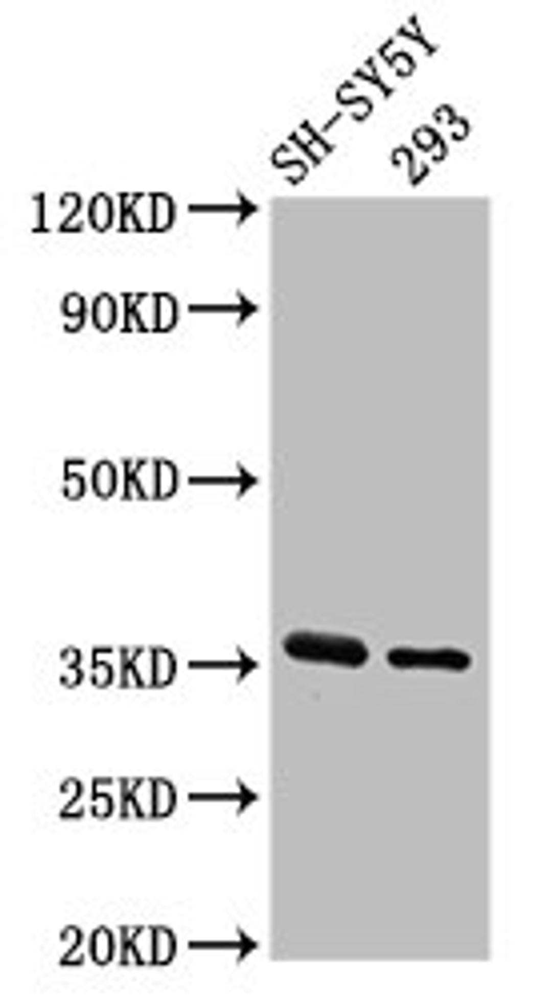 Western Blot. Positive WB detected in: SH-SY5Y whole cell lysate, 293 whole cell lysate. All lanes: GAS1 antibody at 3.2µg/ml. Secondary. Goat polyclonal to rabbit IgG at 1/50000 dilution. Predicted band size: 36 kDa. Observed band size: 36 kDa