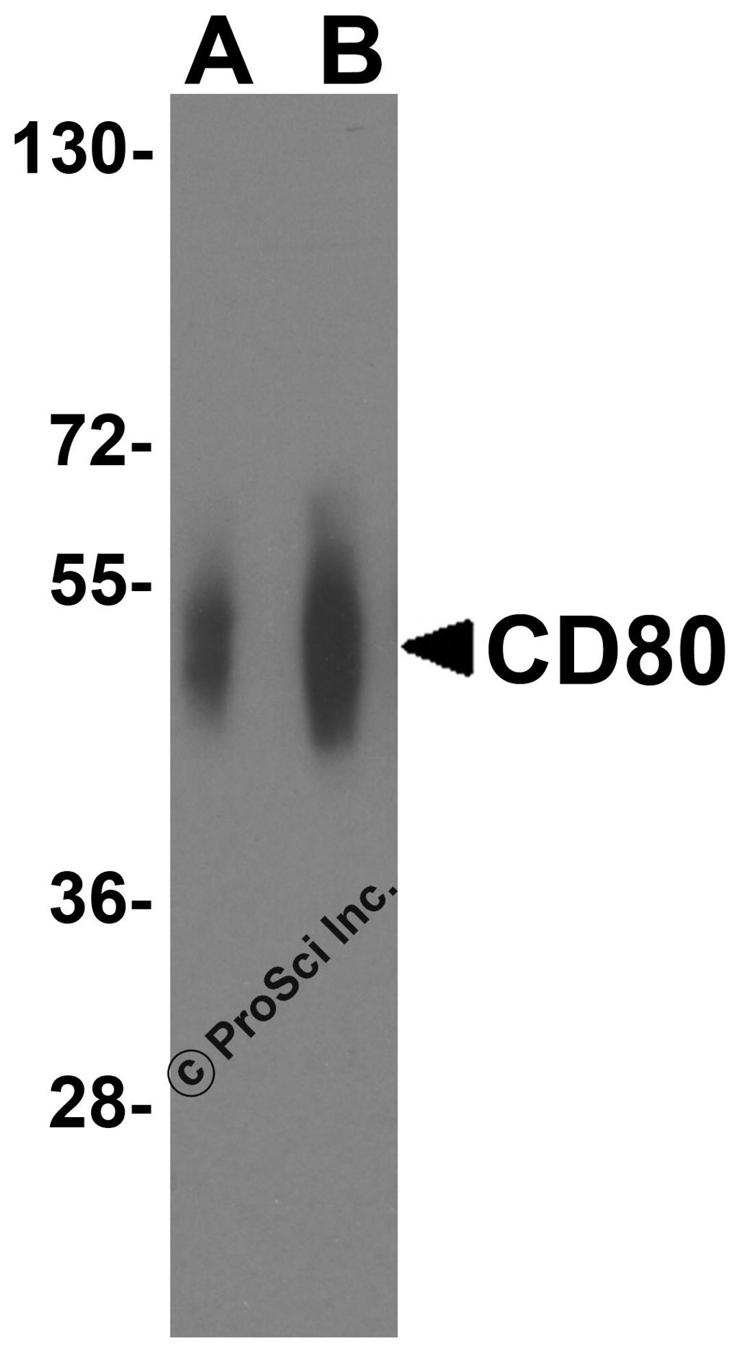 Western blot analysis of CD80 in overexpressing HEK293 cells CD80 antibody at 0.25 and 0.5 μg/ml