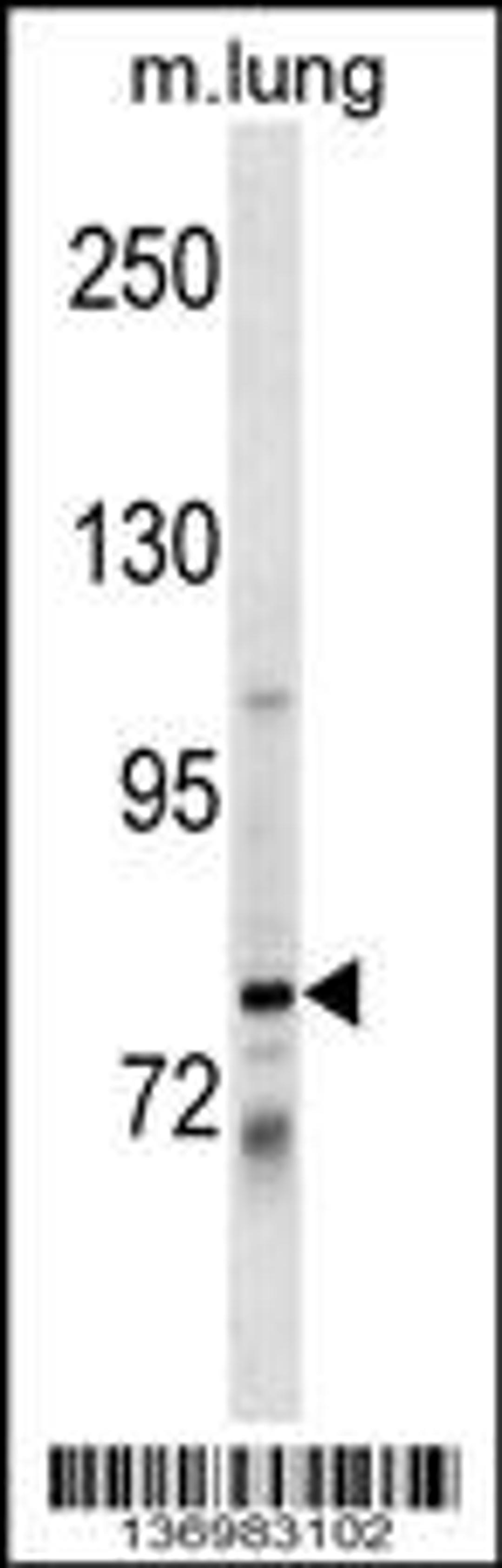 Western blot analysis in mouse lung tissue lysates (35ug/lane).