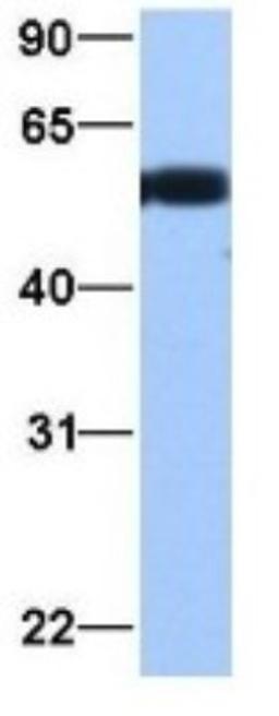 Western Blot: alpha Tubulin 3c Antibody [NBP1-53026] - Jurkat, Antibody Dilution: 1.0 ug/ml TUBA3C is supported by BioGPS gene expression data to be expressed in Jurkat.