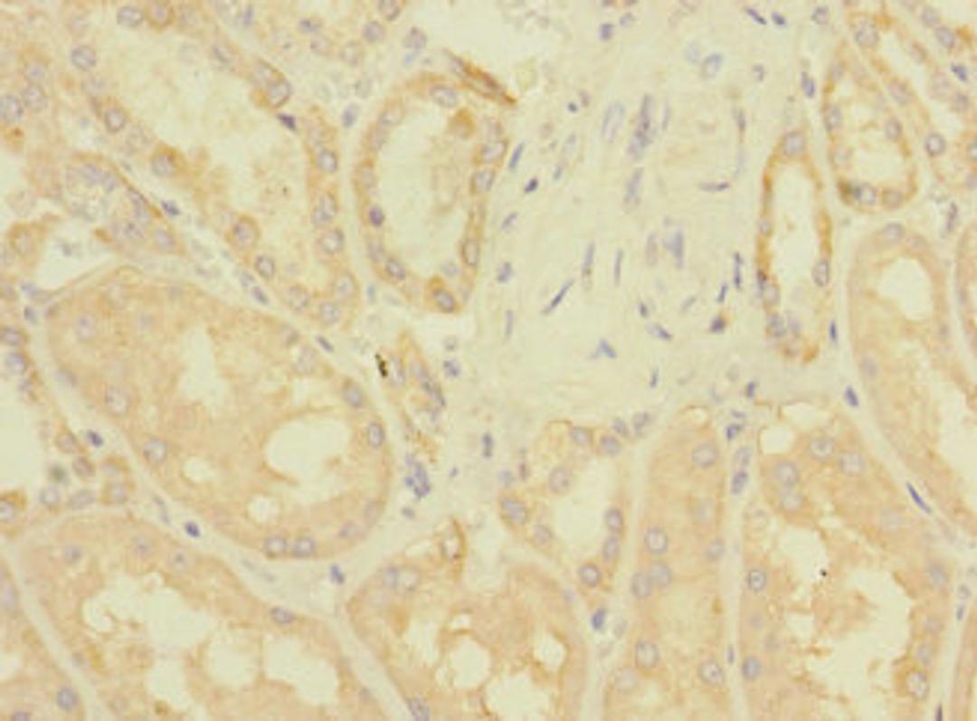 Immunohistochemistry of paraffin-embedded human kidney tissue using CSB-PA026902LA01HU at dilution of 1:100