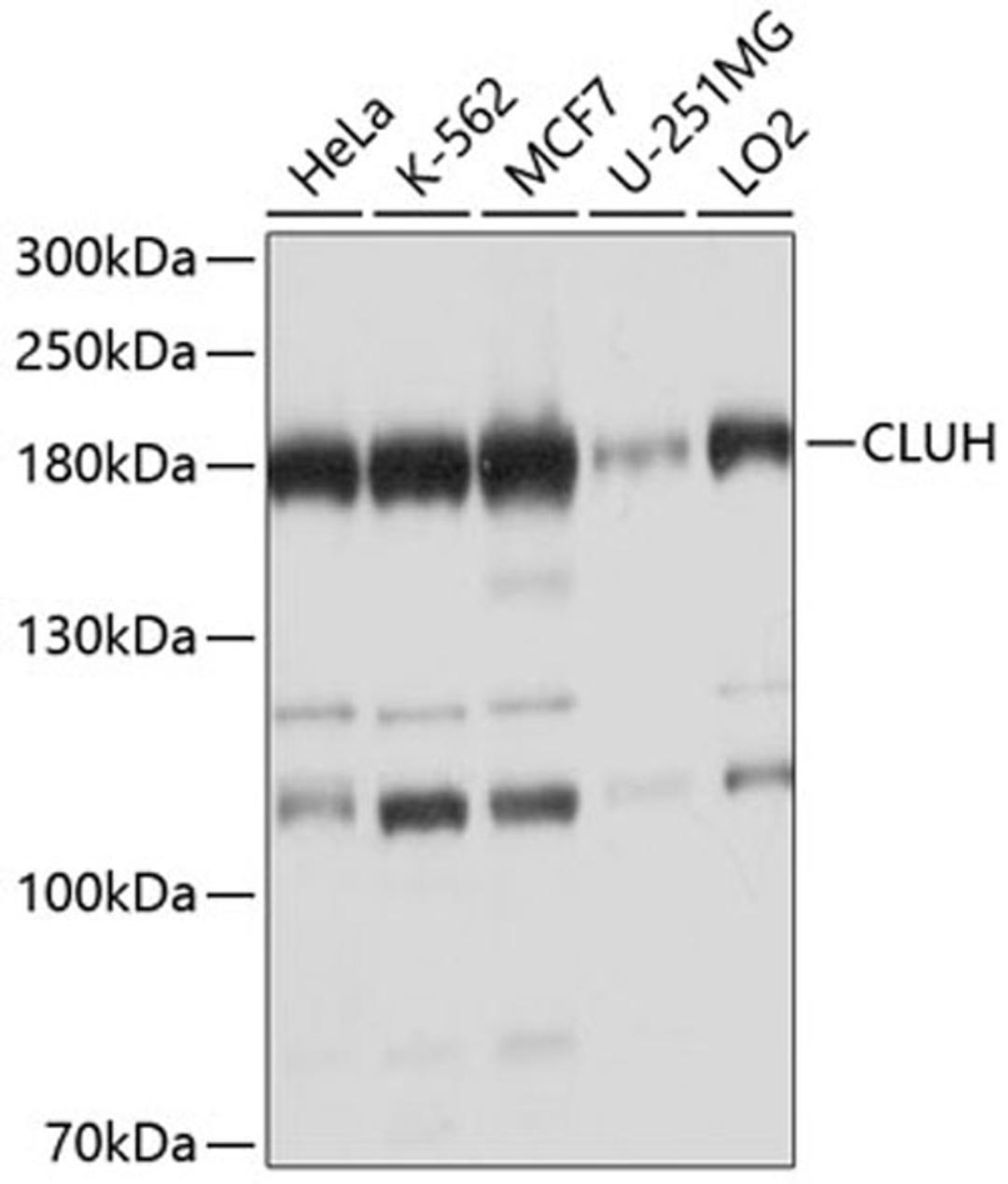 Western blot - CLUH antibody (A10140)