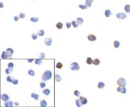 Immunocytochemistry of PD-1 in transfected 293 cells with PD-1 [10B3] antibody at 10 &#956;g/mL. Lower left: Immunocytochemistry in transfected 293 cells with control mouse IgG antibody at 10 &#956;g/mL.