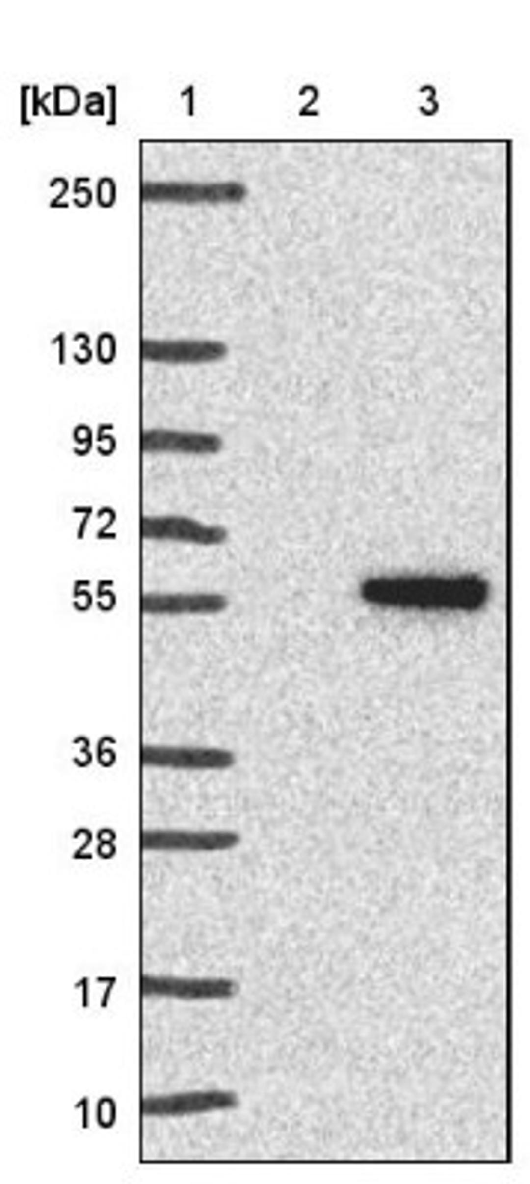 Immunohistochemistry: CKI gamma 3 Antibody [NBP1-91045] - Lane 1: Marker [kDa] 250, 130, 95, 72, 55, 36, 28, 17, 10<br/>Lane 2: Negative control (vector only transfected HEK293T lysate)<br/>Lane 3: Over-expression lysate (Co-expressed with a C-terminal myc-DDK tag (~3.1 kDa) in mammalian HEK293T cells, LY422199)