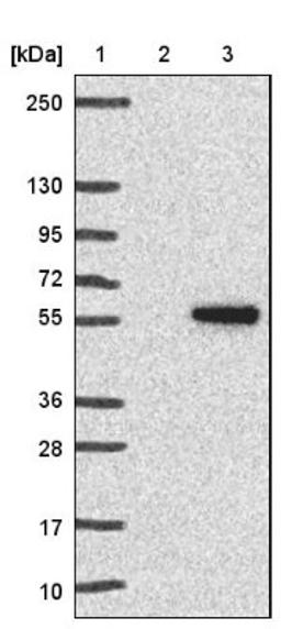 Immunohistochemistry: CKI gamma 3 Antibody [NBP1-91045] - Lane 1: Marker [kDa] 250, 130, 95, 72, 55, 36, 28, 17, 10<br/>Lane 2: Negative control (vector only transfected HEK293T lysate)<br/>Lane 3: Over-expression lysate (Co-expressed with a C-terminal myc-DDK tag (~3.1 kDa) in mammalian HEK293T cells, LY422199)