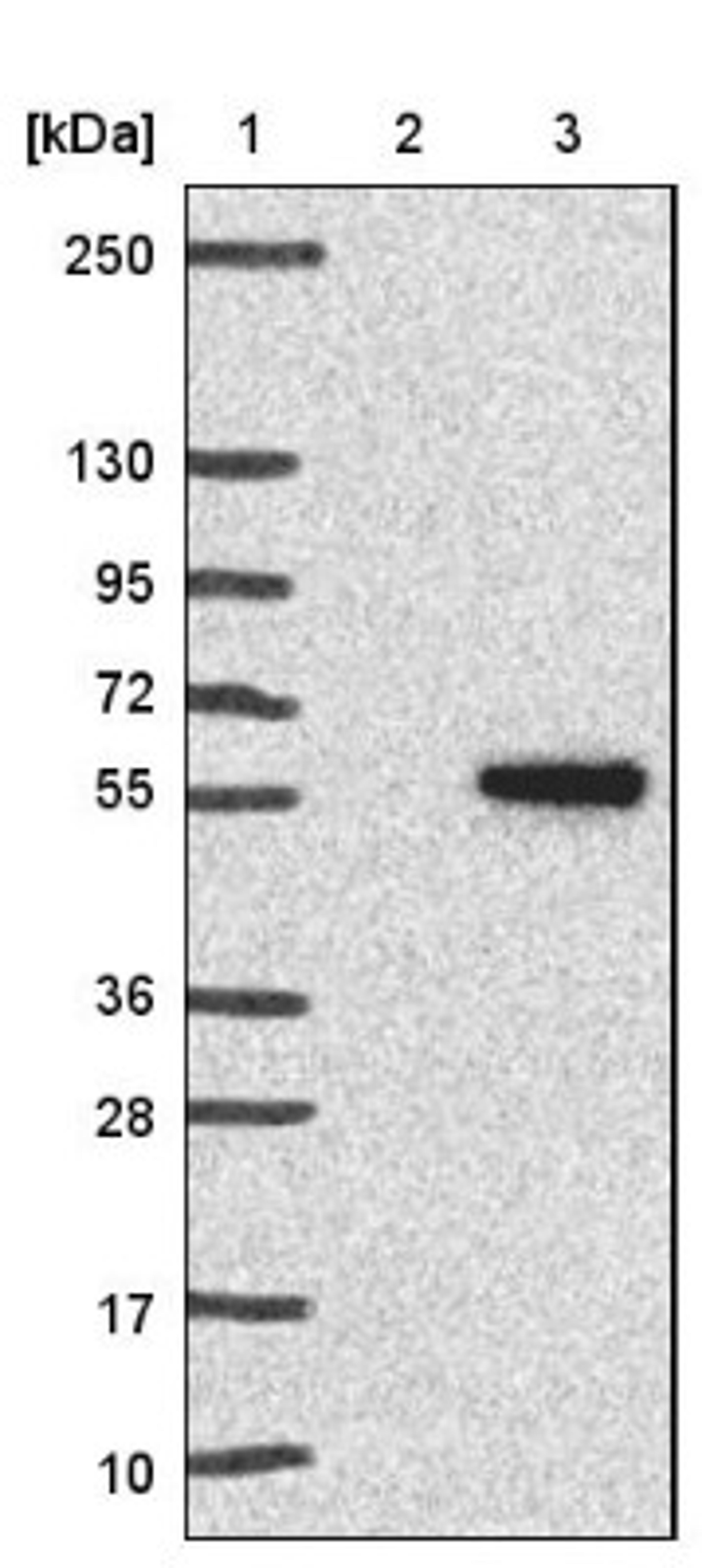 Immunohistochemistry: CKI gamma 3 Antibody [NBP1-91045] - Lane 1: Marker [kDa] 250, 130, 95, 72, 55, 36, 28, 17, 10<br/>Lane 2: Negative control (vector only transfected HEK293T lysate)<br/>Lane 3: Over-expression lysate (Co-expressed with a C-terminal myc-DDK tag (~3.1 kDa) in mammalian HEK293T cells, LY422199)