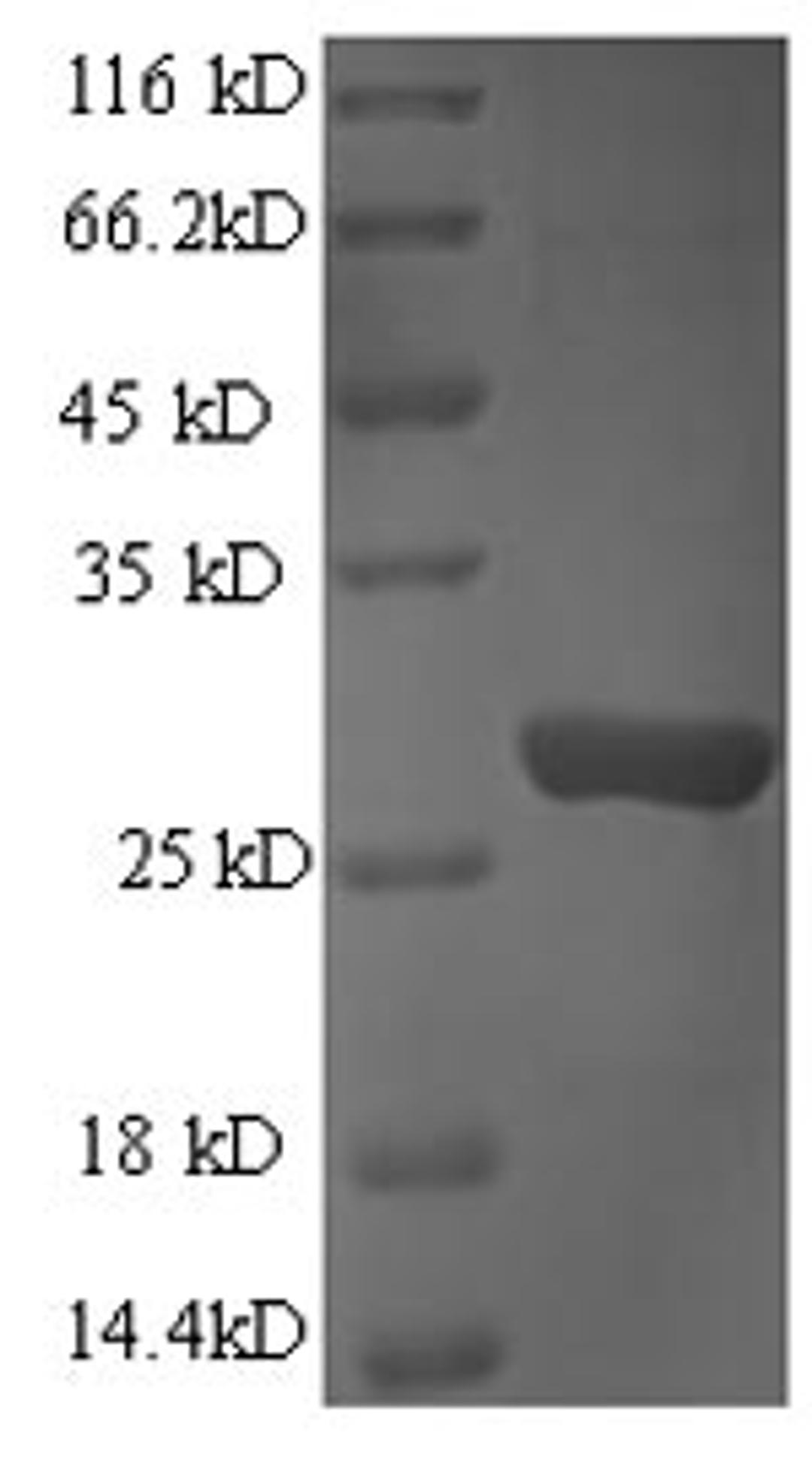 (Tris-Glycine gel) Discontinuous SDS-PAGE (reduced) with 5% enrichment gel and 15% separation gel.