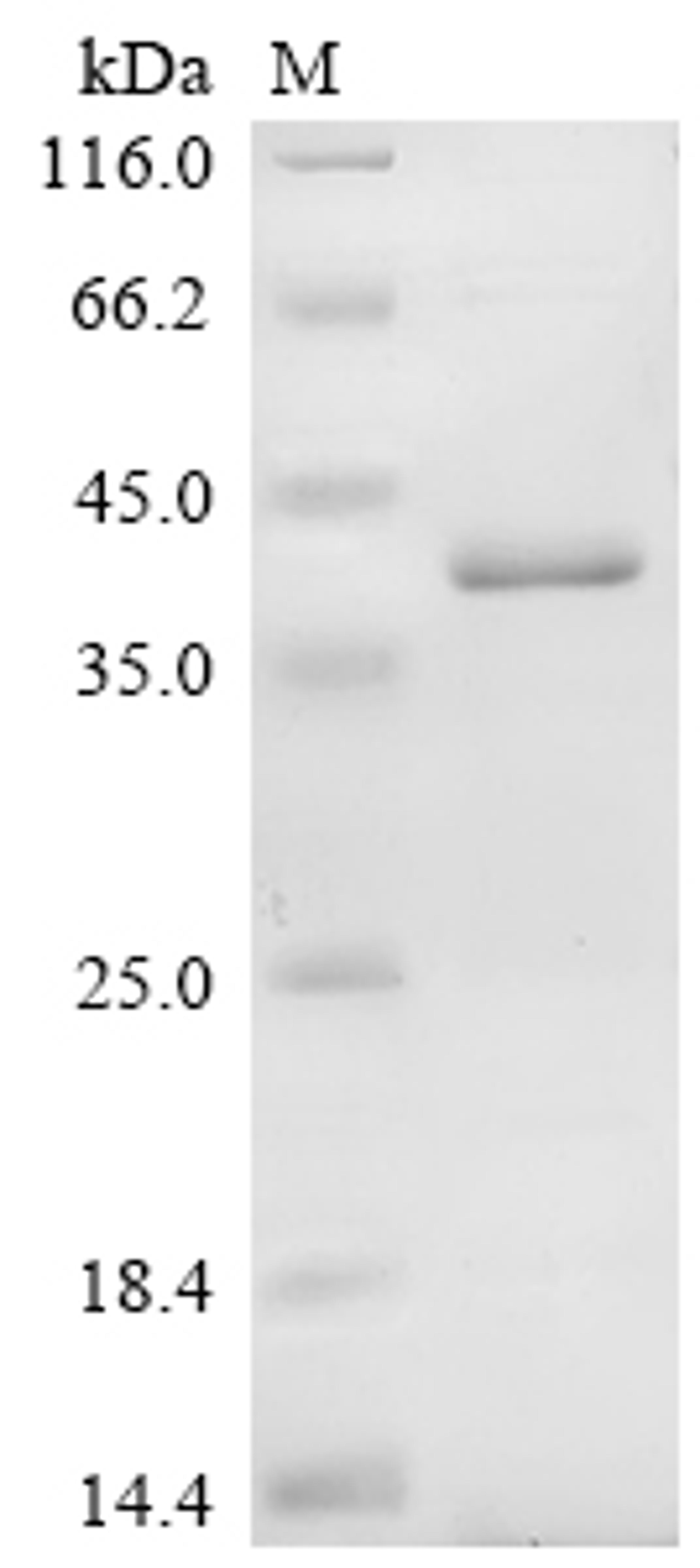 (Tris-Glycine gel) Discontinuous SDS-PAGE (reduced) with 5% enrichment gel and 15% separation gel.