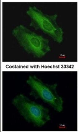 Immunocytochemistry/Immunofluorescence: SNX18 Antibody [NBP2-20443] - Immunofluorescence analysis of methanol-fixed HeLa, using antibody at 1:200 dilution.