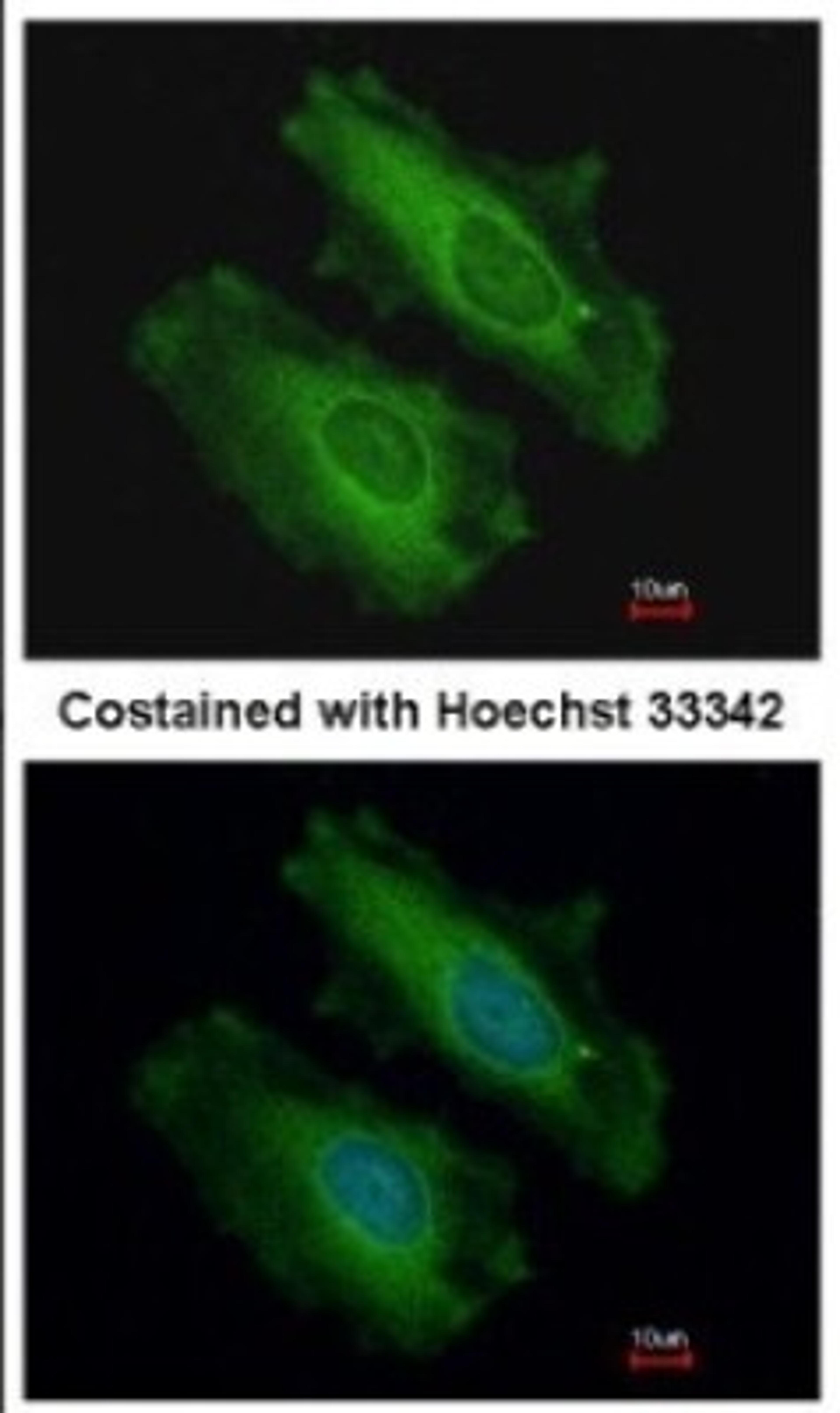 Immunocytochemistry/Immunofluorescence: SNX18 Antibody [NBP2-20443] - Immunofluorescence analysis of methanol-fixed HeLa, using antibody at 1:200 dilution.