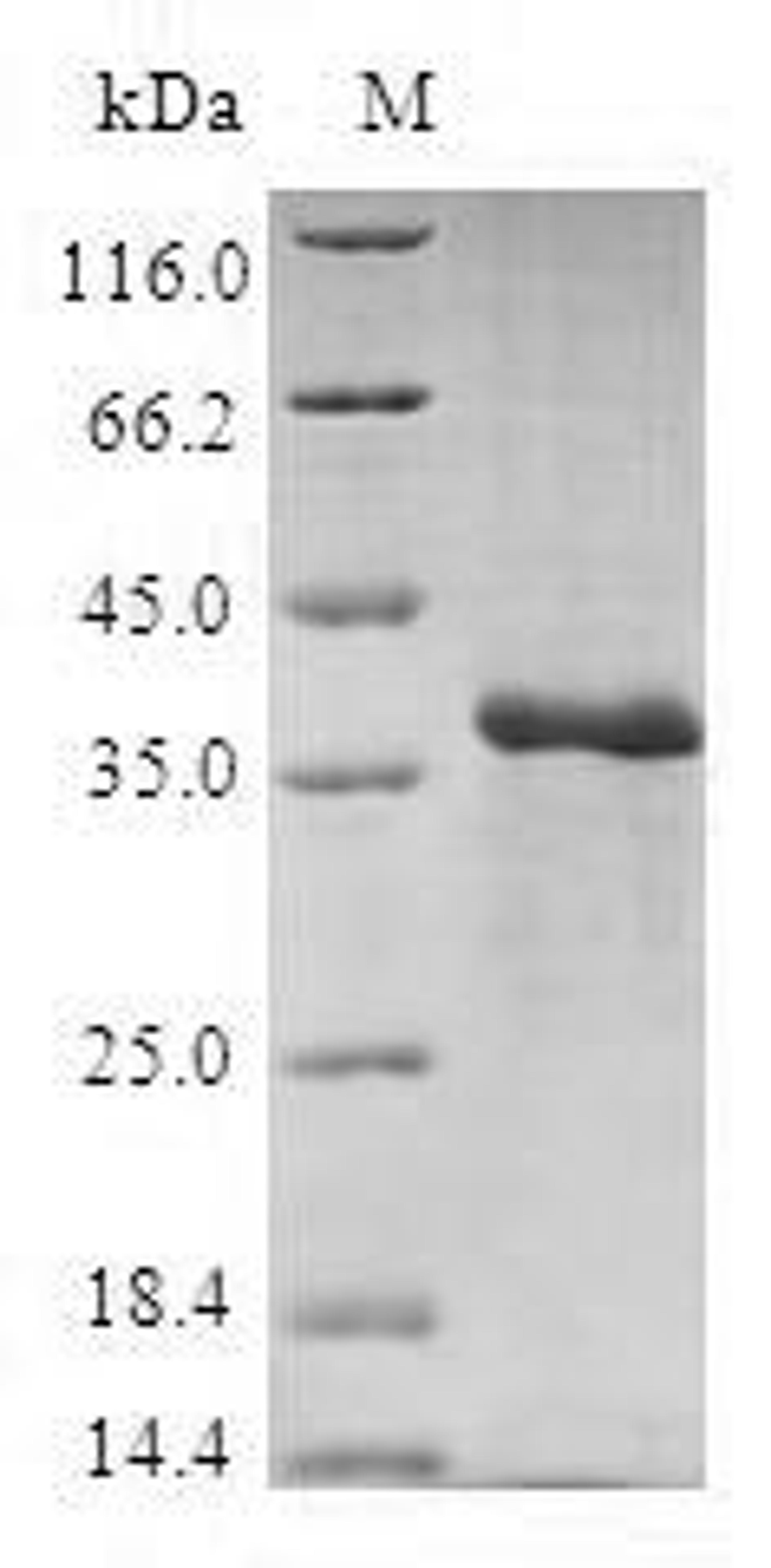 (Tris-Glycine gel) Discontinuous SDS-PAGE (reduced) with 5% enrichment gel and 15% separation gel.