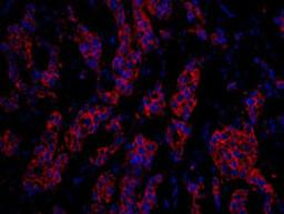 Detection of human CKAP4 by immunohistochemistry.