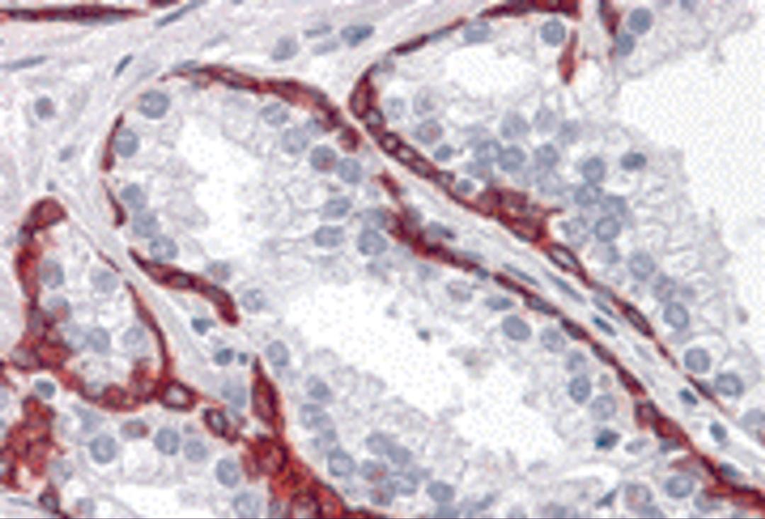 Immunohistochemistry of BMP15 in human prostate tissue with BMP15 antibody at 10 &#956;g/mL