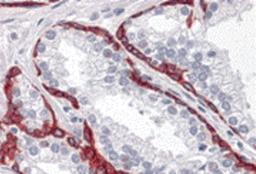 Immunohistochemistry of BMP15 in human prostate tissue with BMP15 antibody at 10 μg/mL