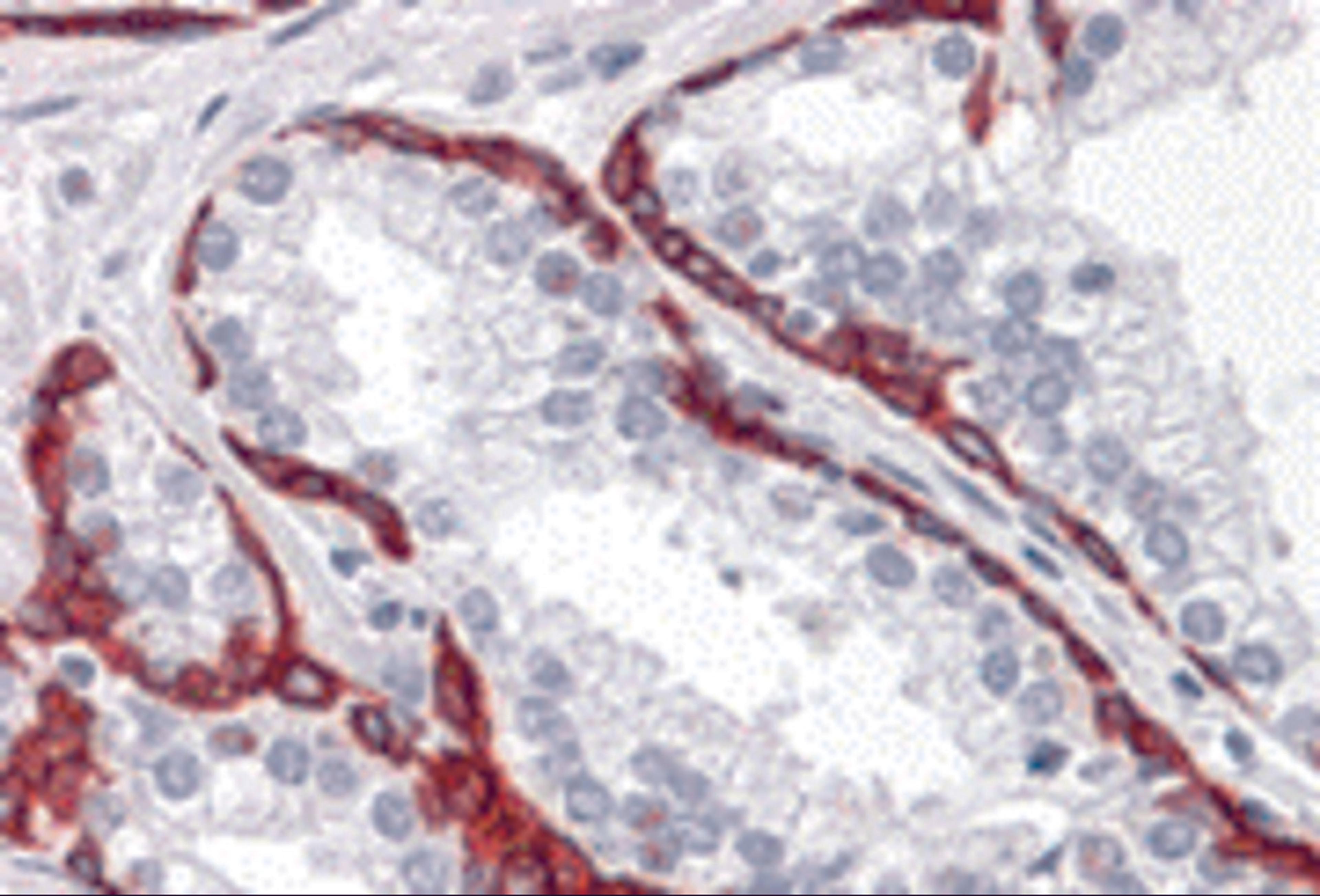 Immunohistochemistry of BMP15 in human prostate tissue with BMP15 antibody at 10 μg/mL