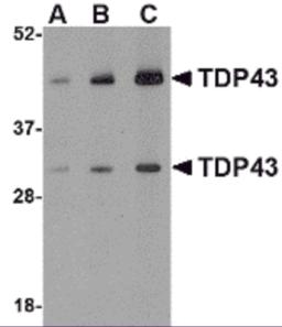 Western blot analysis of TDP43 in HeLa cell lysate with TDP43 antibody at (A) 0.5, (B) 1 and (C) 2 &#956;g/mL.