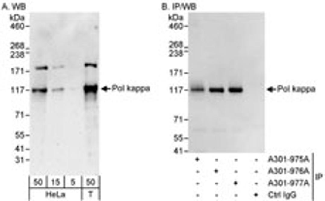 Detection of human Pol kappa by western blot and immunoprecipitation.