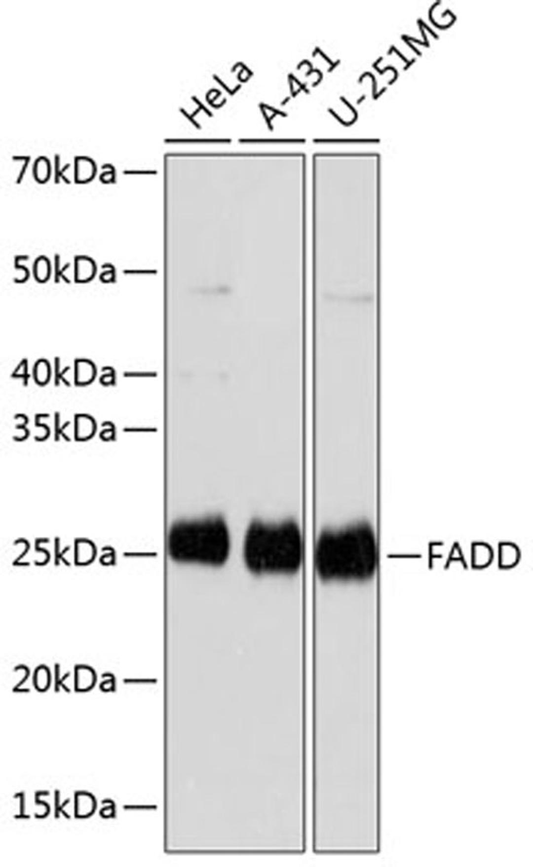 Western blot - FADD antibody (A19049)