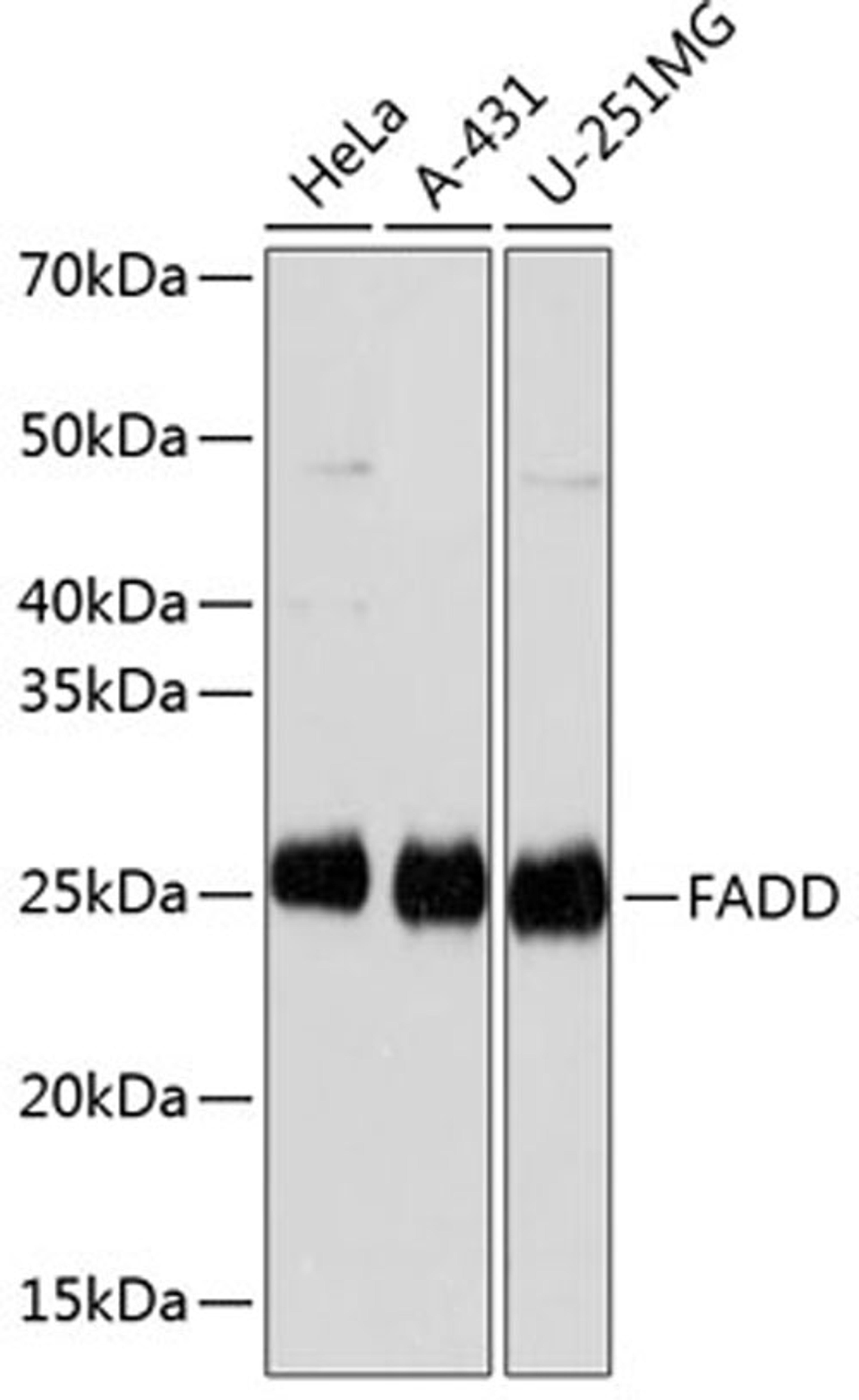 Western blot - FADD antibody (A19049)