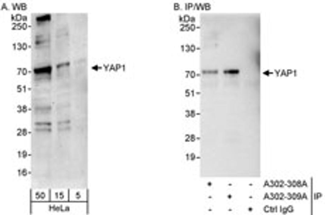 Detection of human YAP1 by western blot and immunoprecipitation.