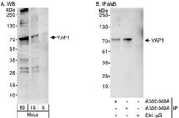 Detection of human YAP1 by western blot and immunoprecipitation.