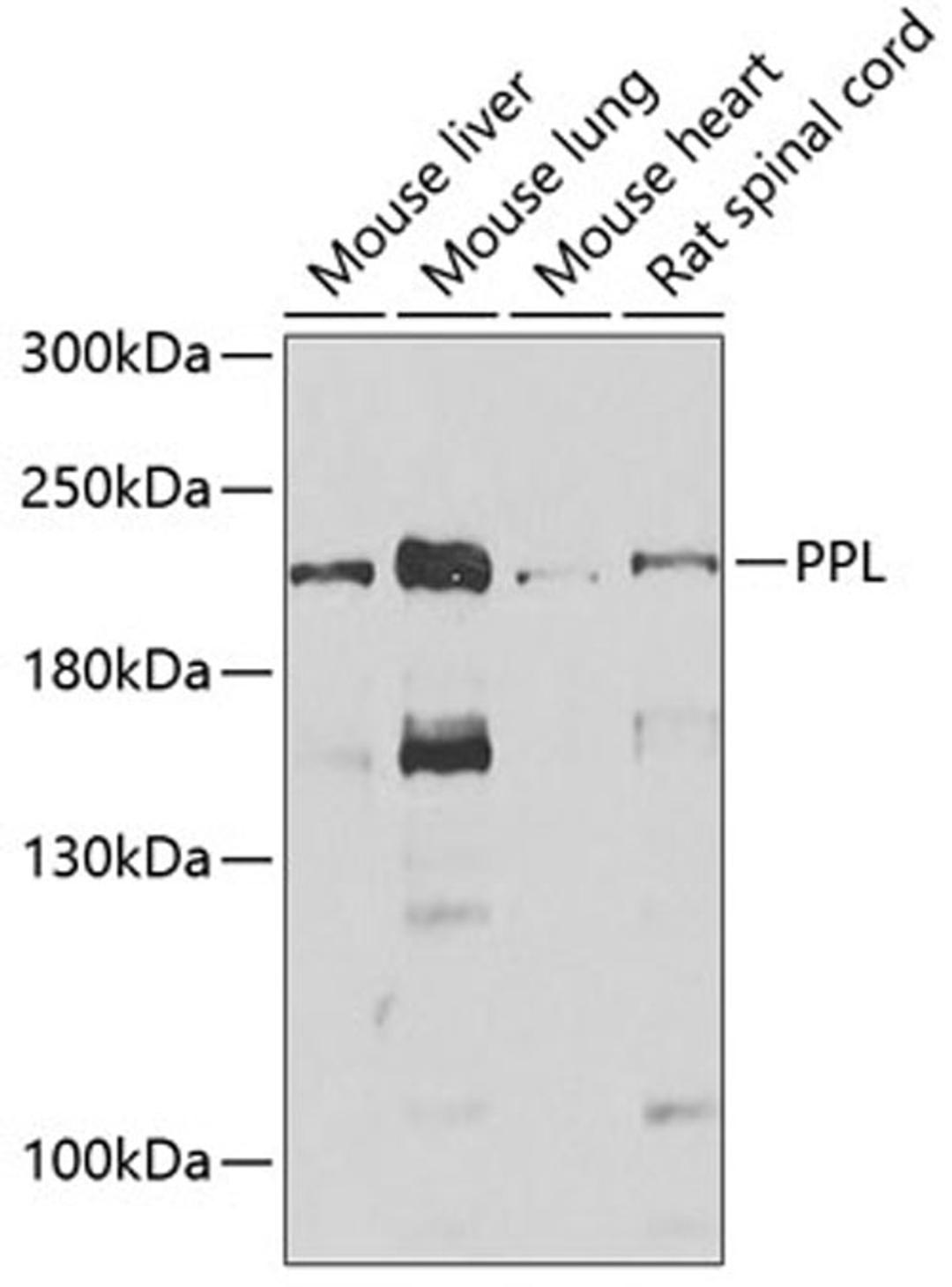 Western blot - PPL antibody (A6950)