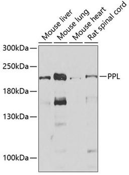 Western blot - PPL antibody (A6950)