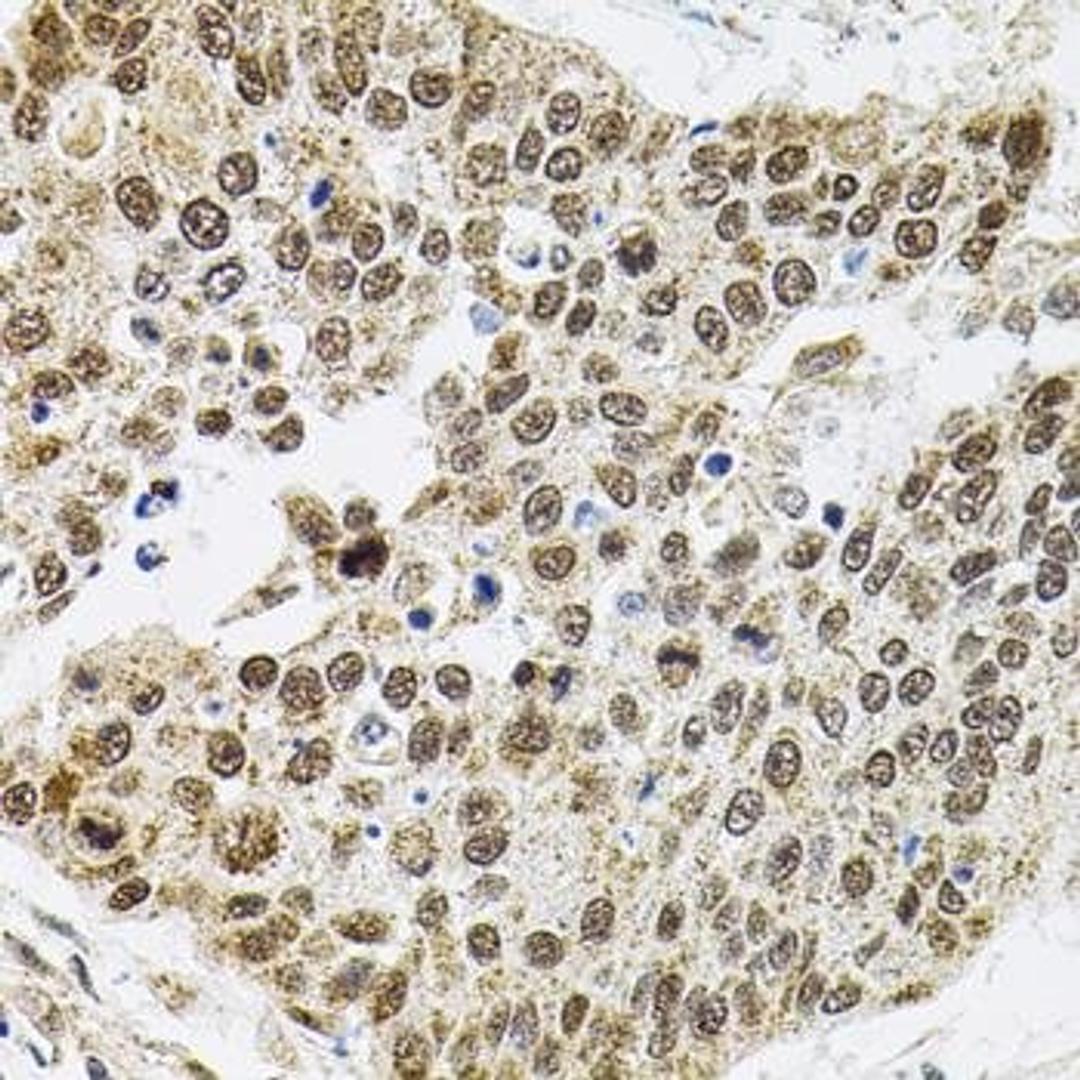 Immunohistochemical staining of mouse brain tissue using BAF60a antibody