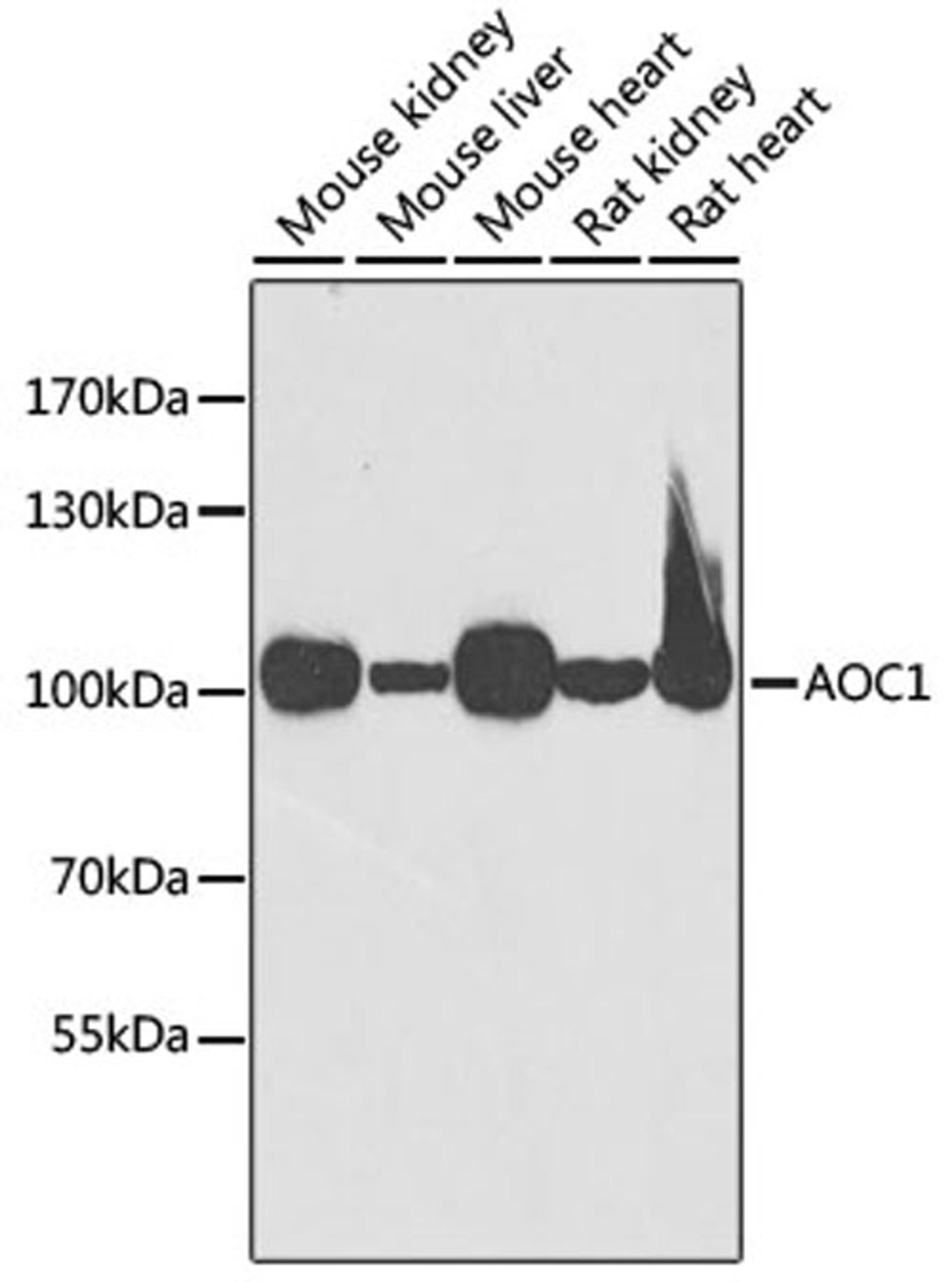 Western blot - AOC1 antibody (A6249)