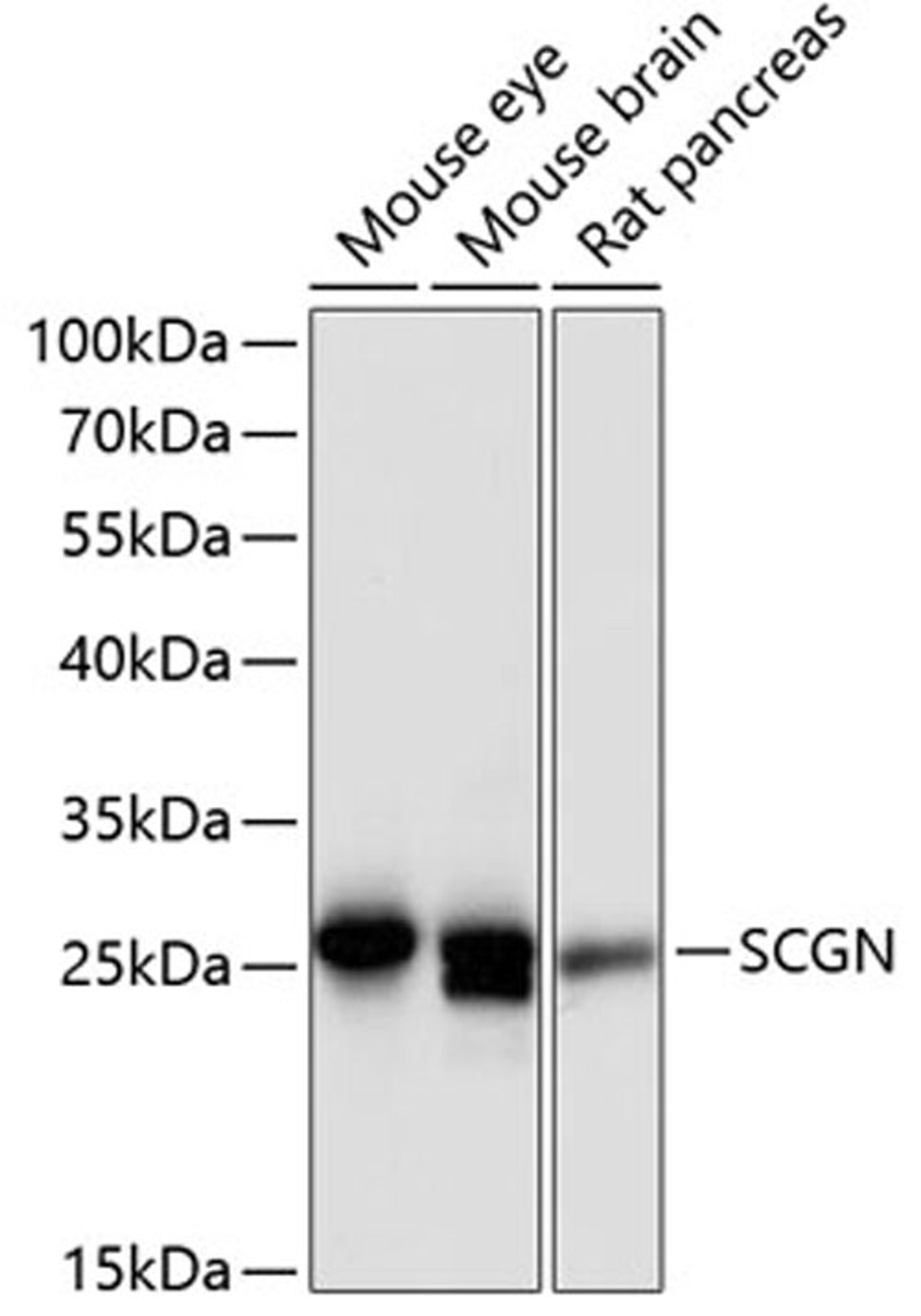 Western blot - SCGN antibody (A12897)