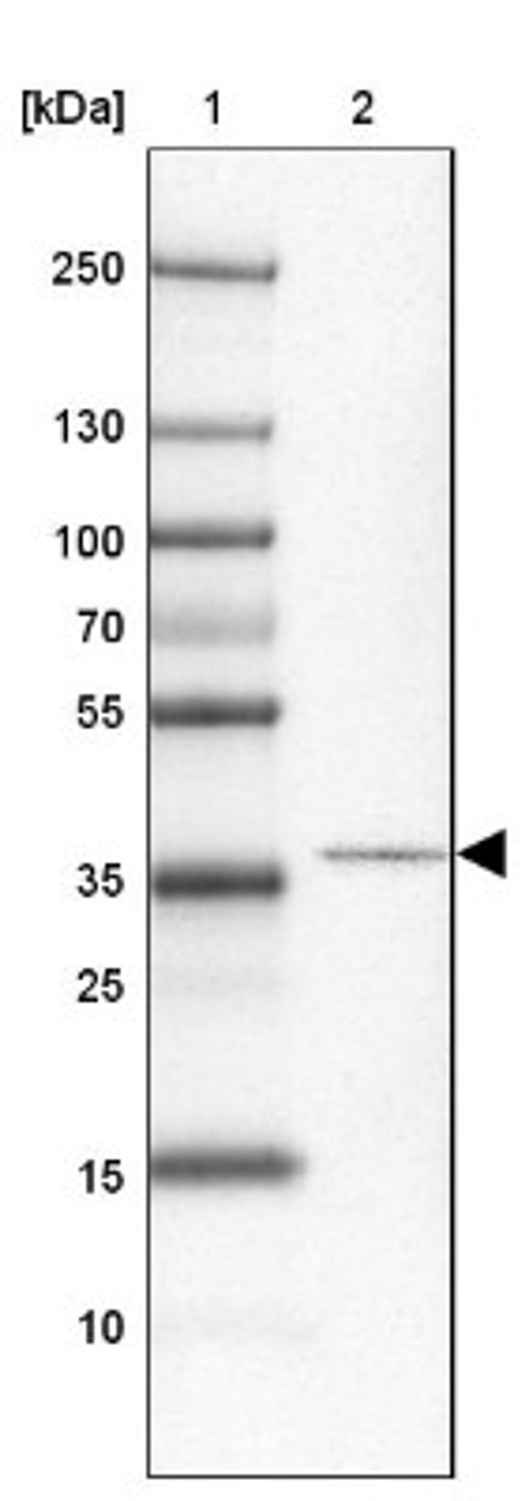 Western Blot: CCDC113 Antibody [NBP2-14443] - Lane 1: Marker [kDa] 250, 130, 100, 70, 55, 35, 25, 15, 10<br/>Lane 2: Testis