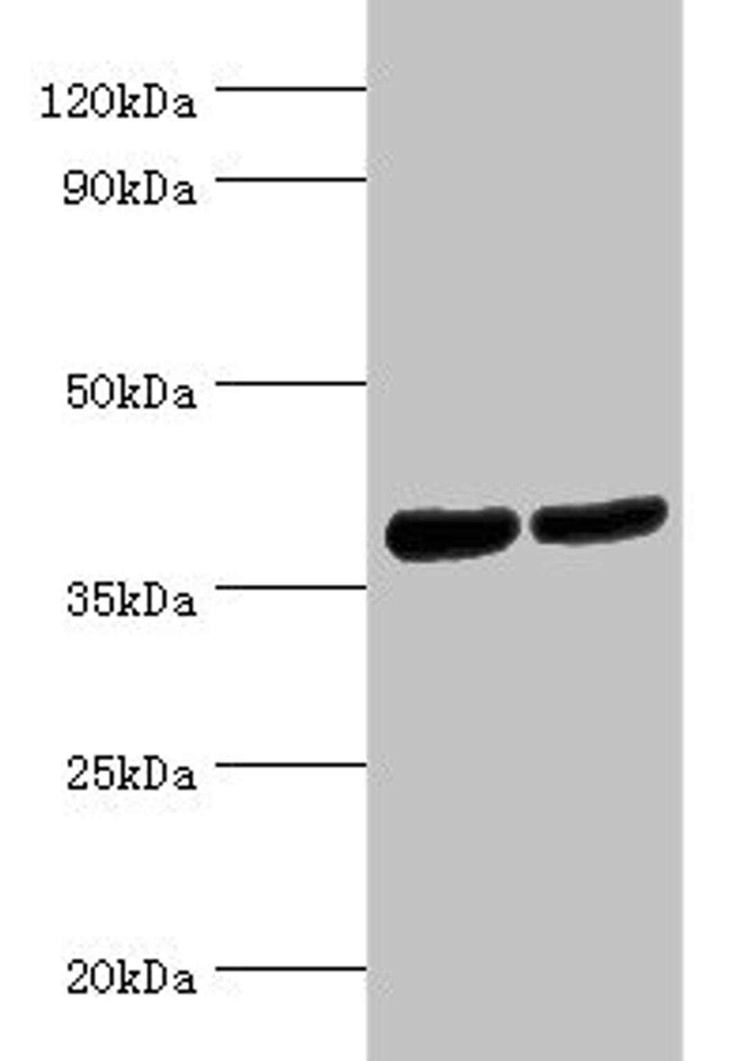 Western blot. All lanes: Renin receptor antibody at 2ug/ml. Lane 1: Hela whole cell lysate. Lane 2: Mouse heart tissue. Secondary. Goat polyclonal to rabbit IgG at 1/10000 dilution. Predicted band size: 40, 36 kDa. Observed band size: 40 kDa. 