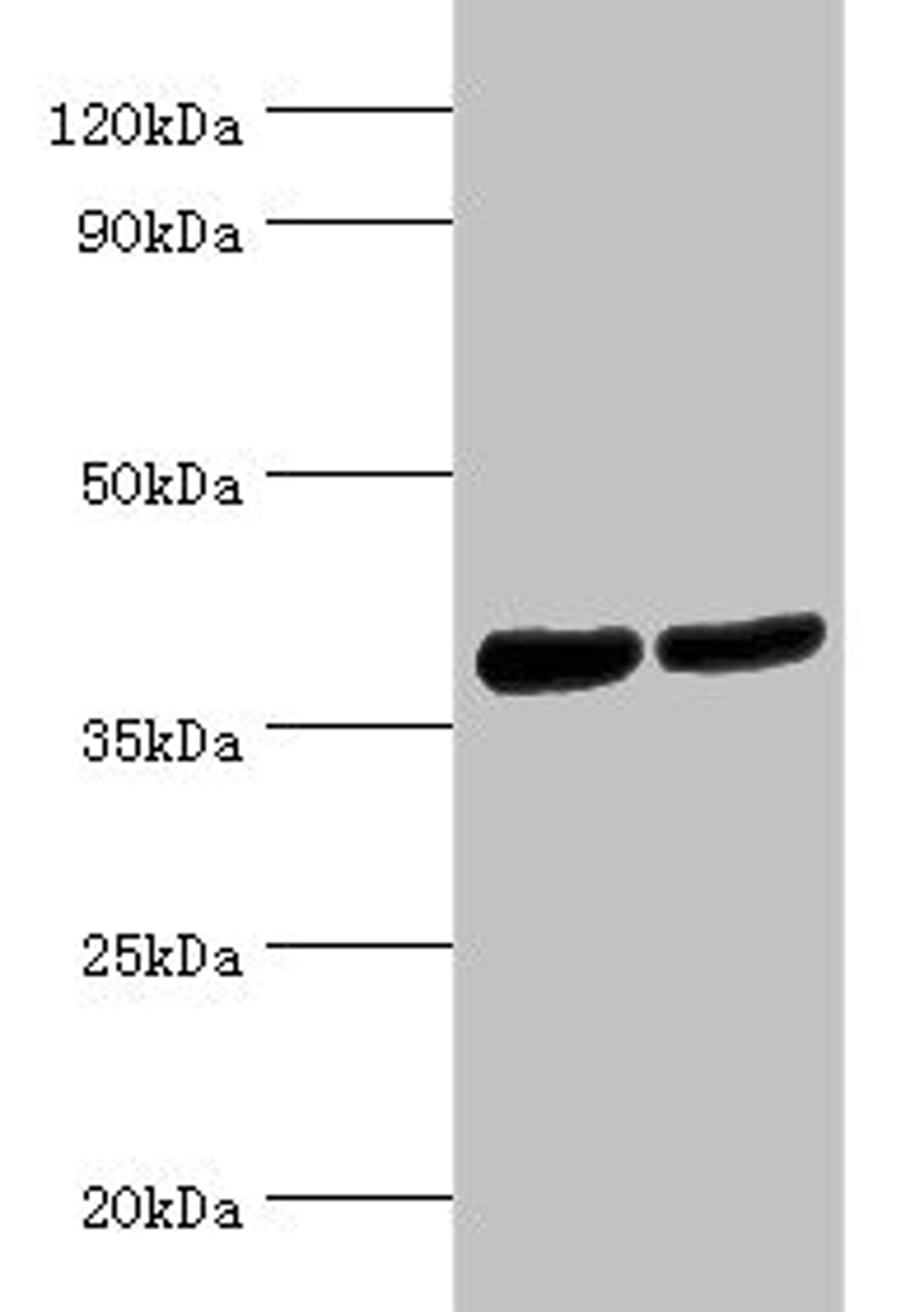 Western blot. All lanes: Renin receptor antibody at 2ug/ml. Lane 1: Hela whole cell lysate. Lane 2: Mouse heart tissue. Secondary. Goat polyclonal to rabbit IgG at 1/10000 dilution. Predicted band size: 40, 36 kDa. Observed band size: 40 kDa. 