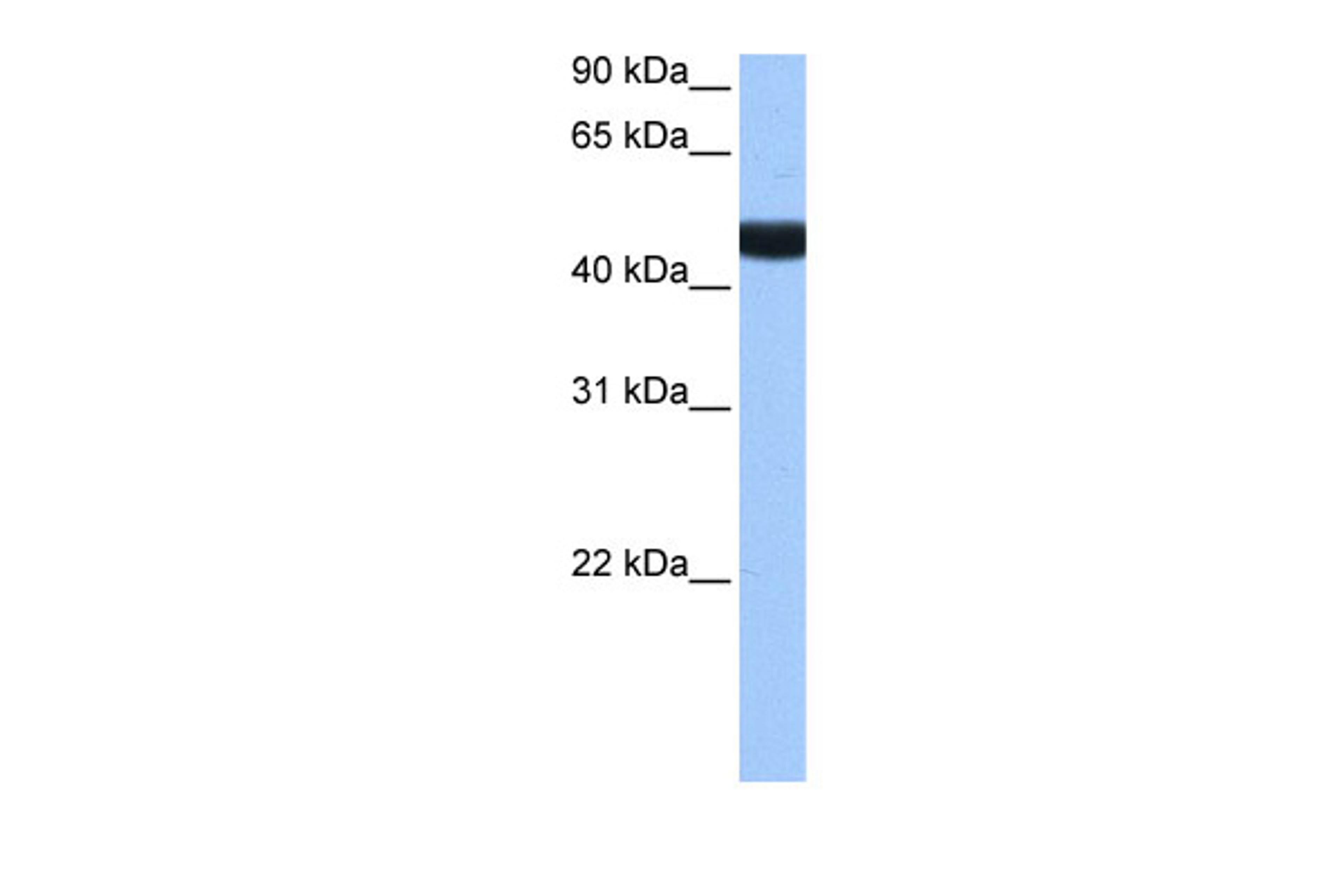 Antibody used in WB on Human Brain at 0.2-1 ug/ml.