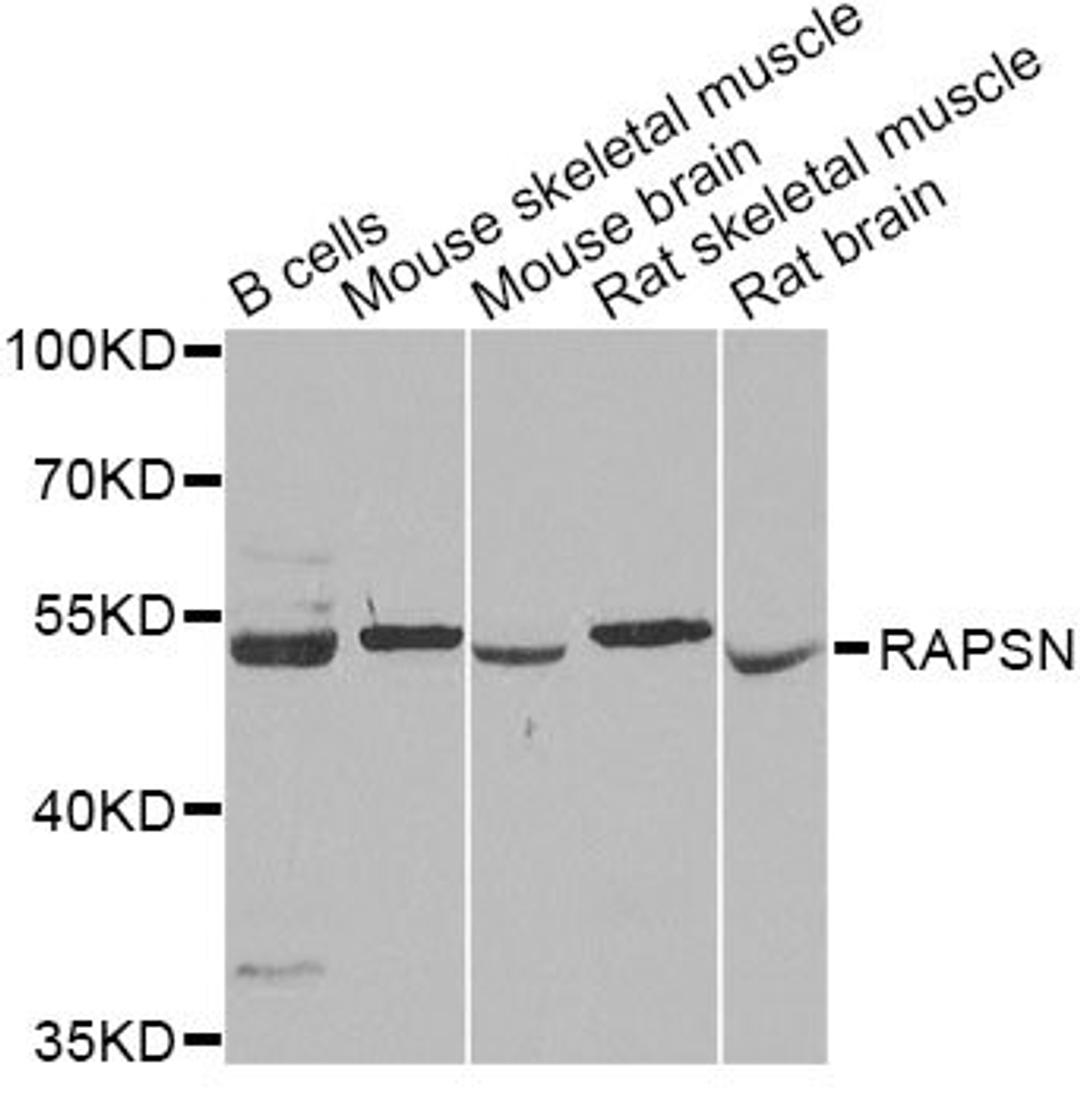 Western blot - RAPSN Antibody (A6716)